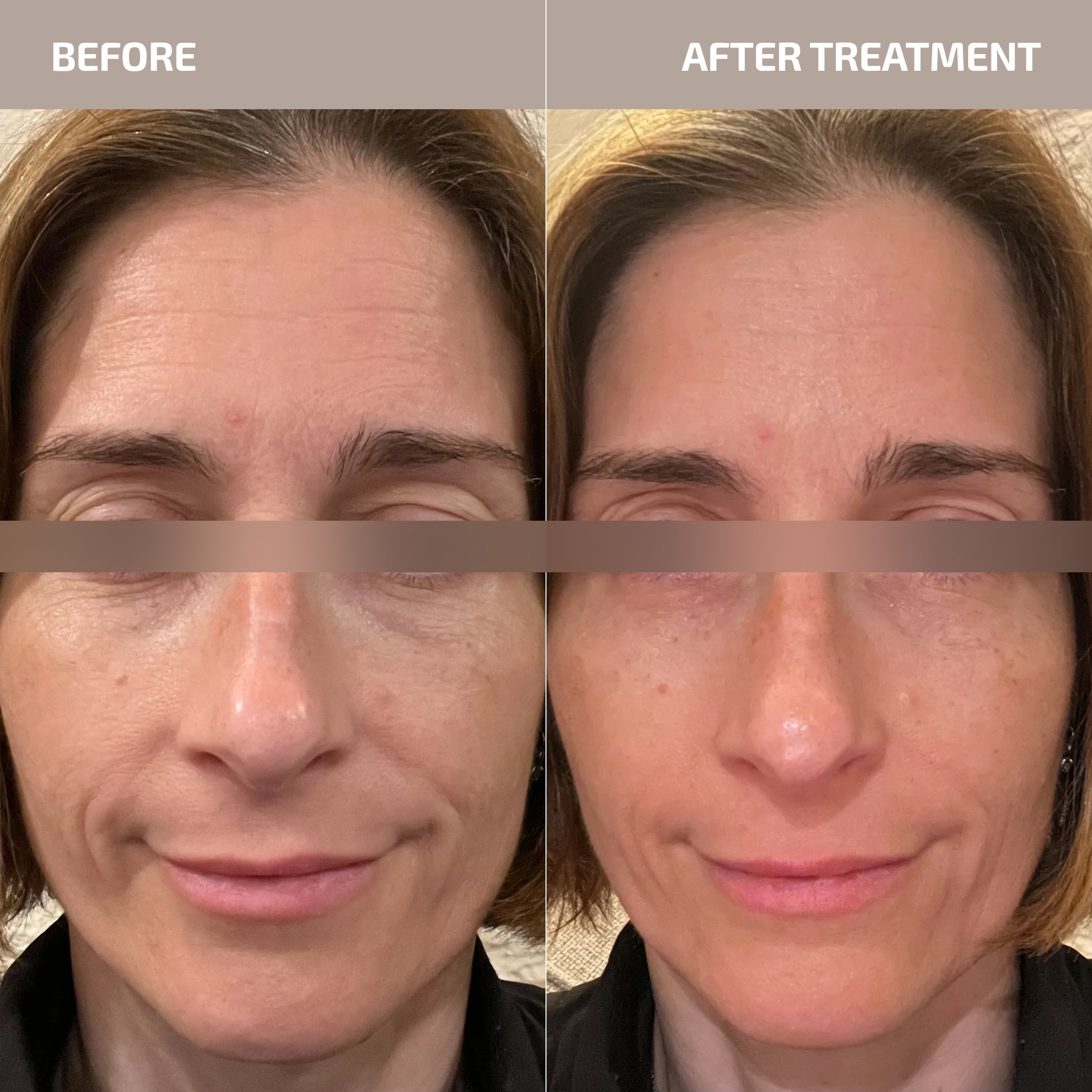 ANTÜ  Refining Eye Cream