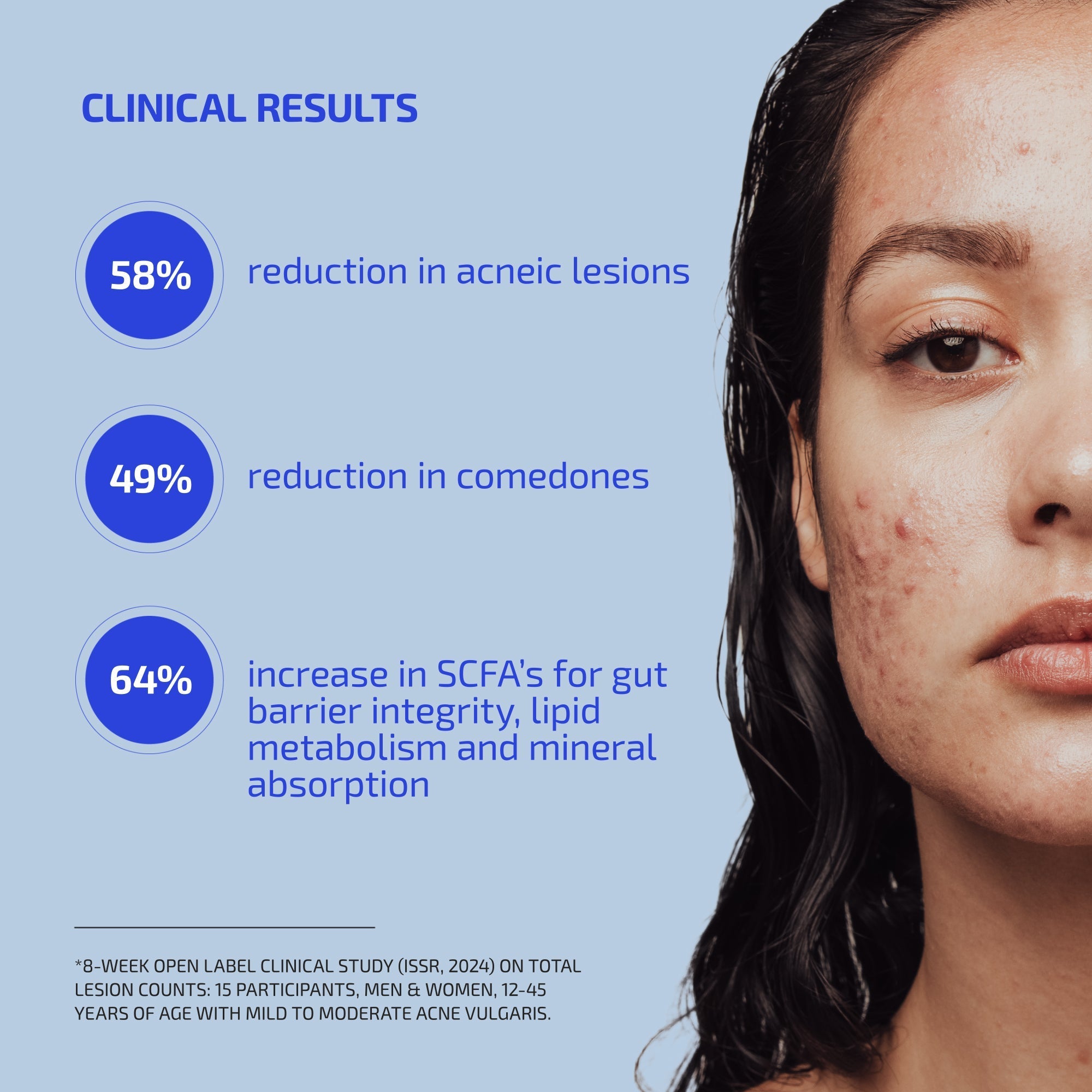 Shaant ClearSkin Probiotic Supplement 2.0