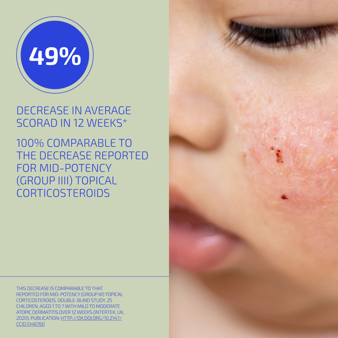 Skin Barrier Eczema-Prone Relief System (Toddler: 1-3)