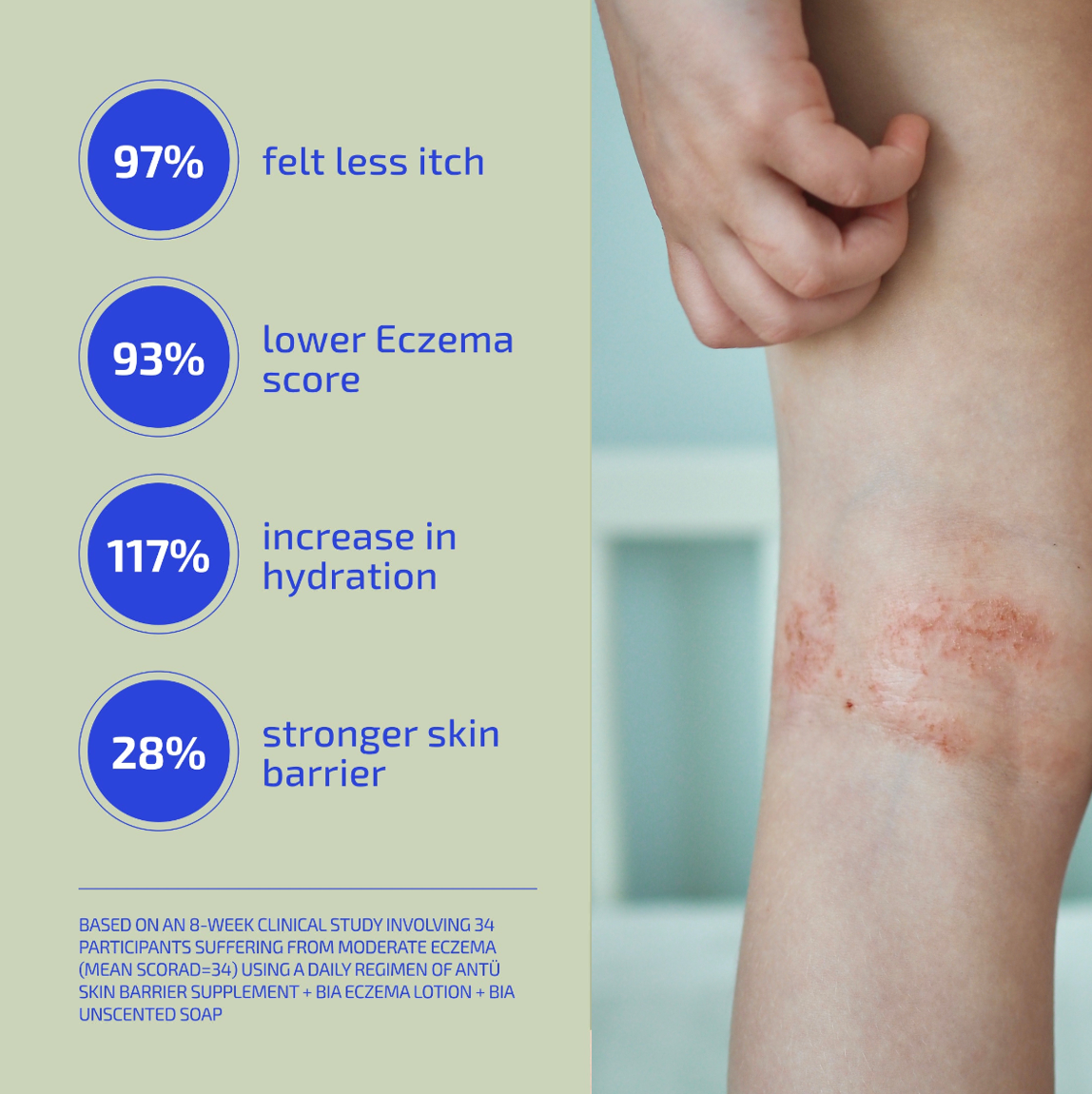 Skin Barrier Eczema-Prone Relief System (Teen: 13-18)